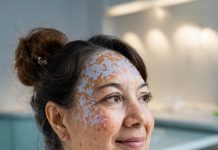 Psoriasis introduccion